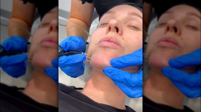 Woman getting a Dermalinfusion facial