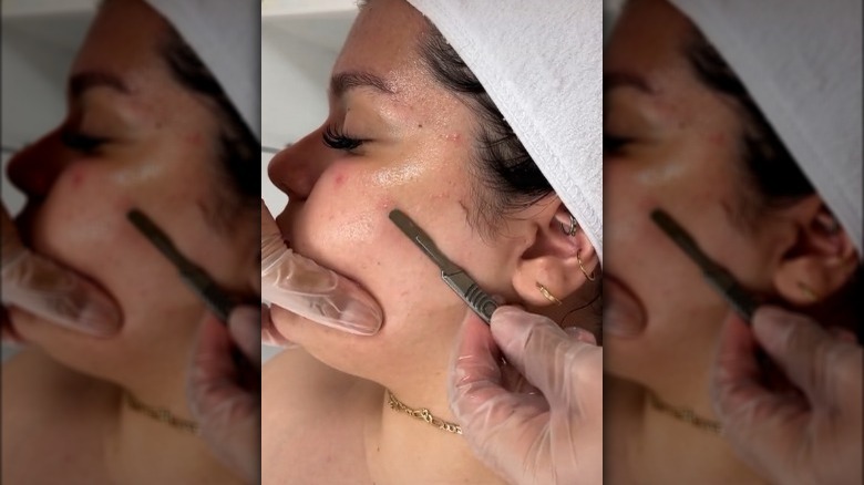 Women getting a Dermaplaning facial