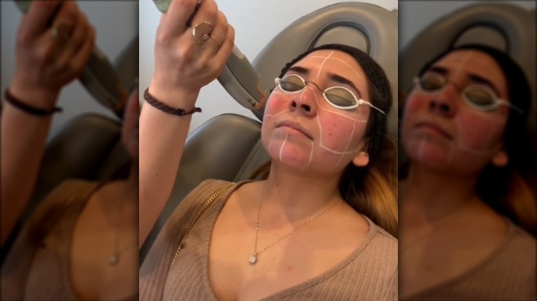 Woman getting Laser Genesis treatment