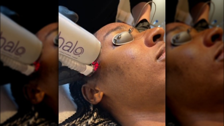 A woman getting Sciton Halo treatment