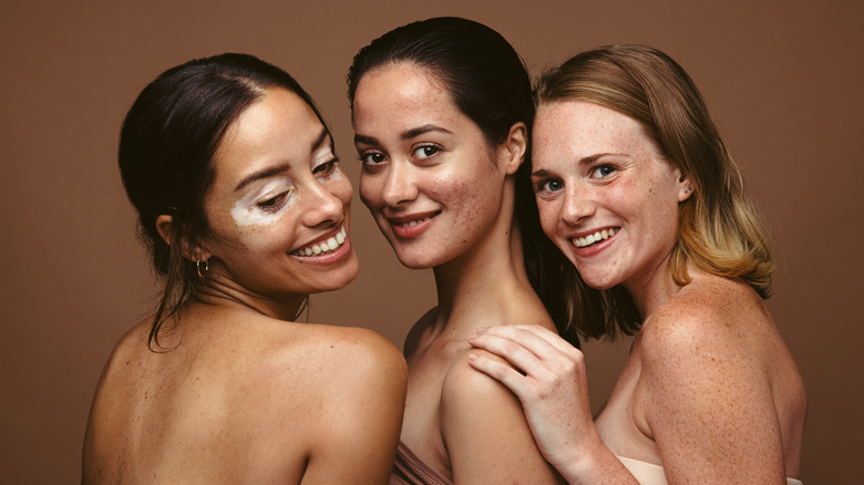 Women with skin conditions smiling