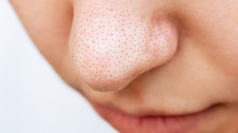 Close up of a woman's nose with blackheads