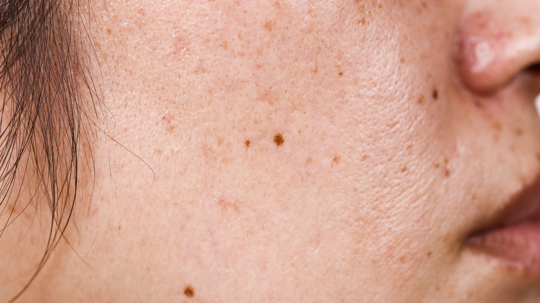 close up or pores
