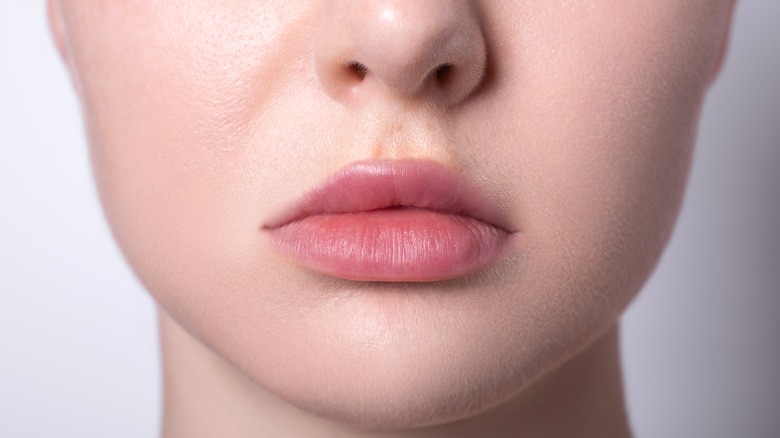 woman with asymmetrical lip filler