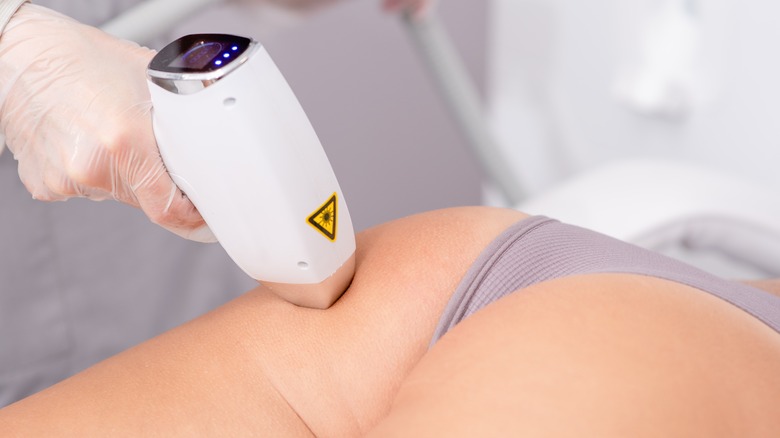 Laser hair removal on butt