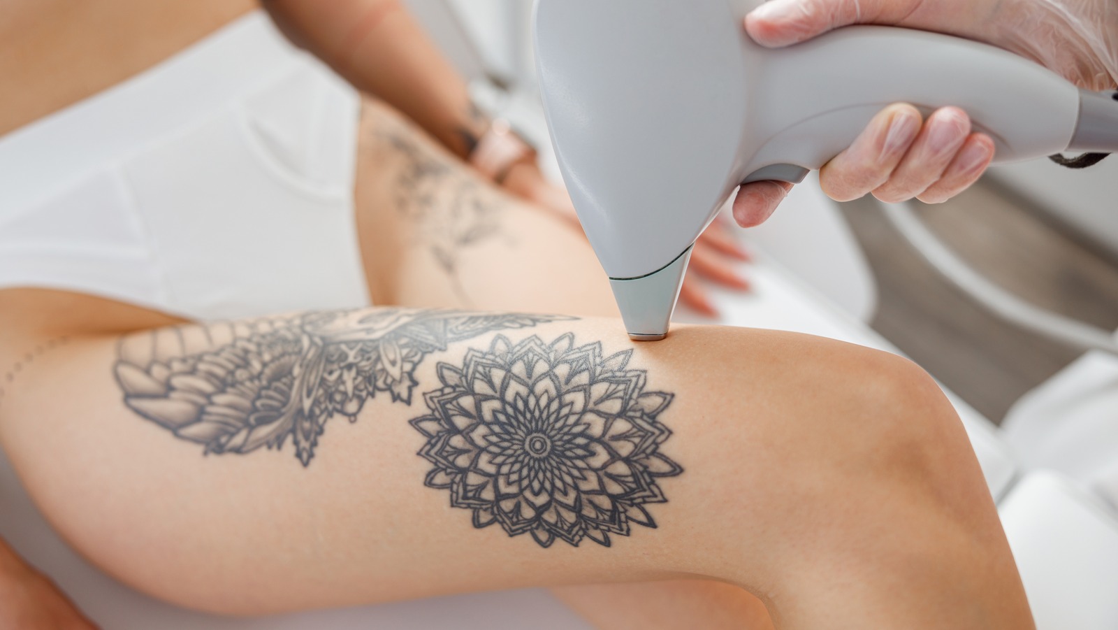 Dalia Aziz Aesthetics  Can Laser Hair Removal be done over a tattooed  area The short answer is NO Its simply not safe to get laser hair  removal over a tattoo If