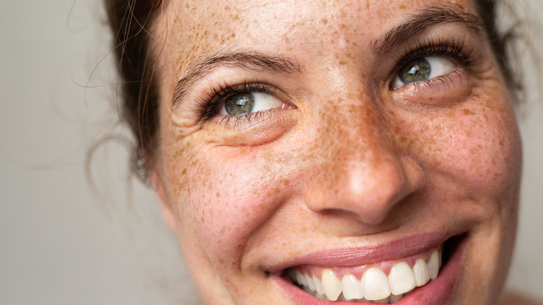 Freckled woman laughing