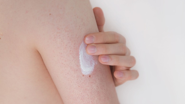 Applying lotion to keratosis pilaris
