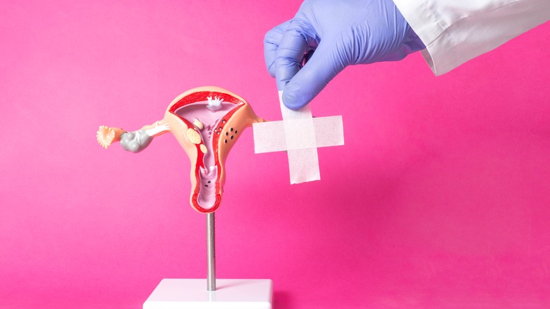 A surgeon with a model of the female reproductive system