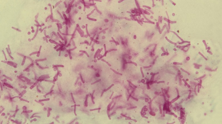 Dandruff fungus under a microscope