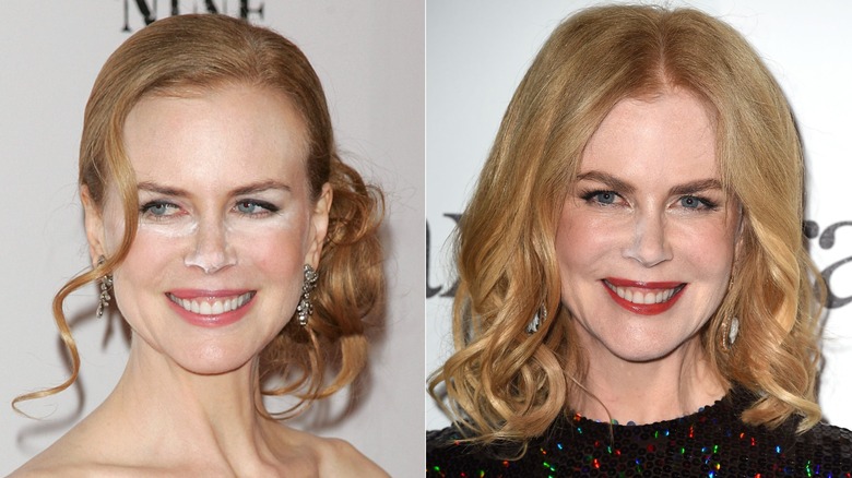 Nicole Kidman with visible powder on her face