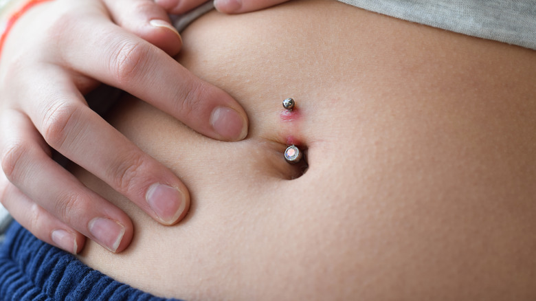 Irritated bellybutton piercing