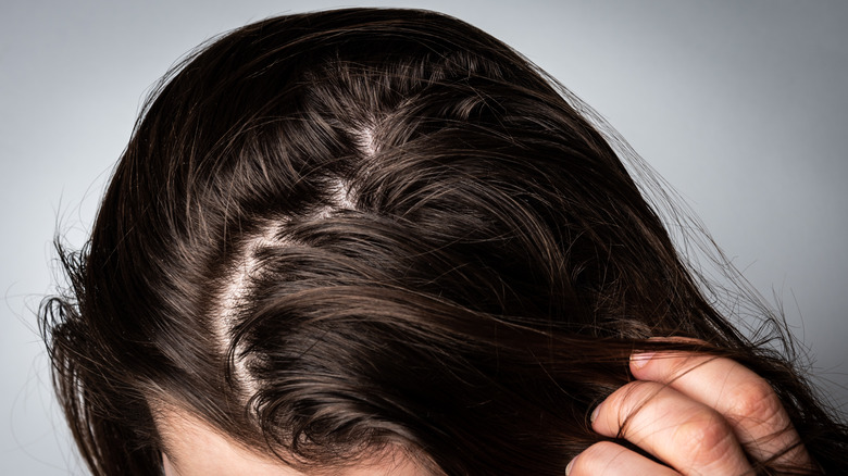 Woman showing scalp