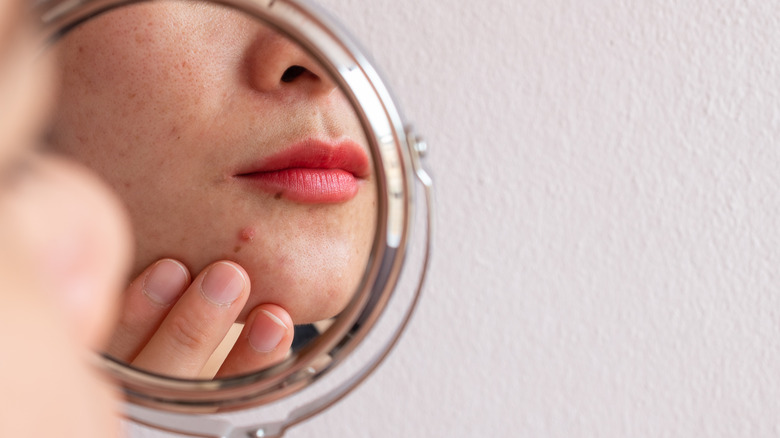 woman looking at pimple in mirror