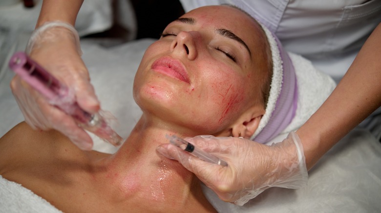 A woman having her face microneedled
