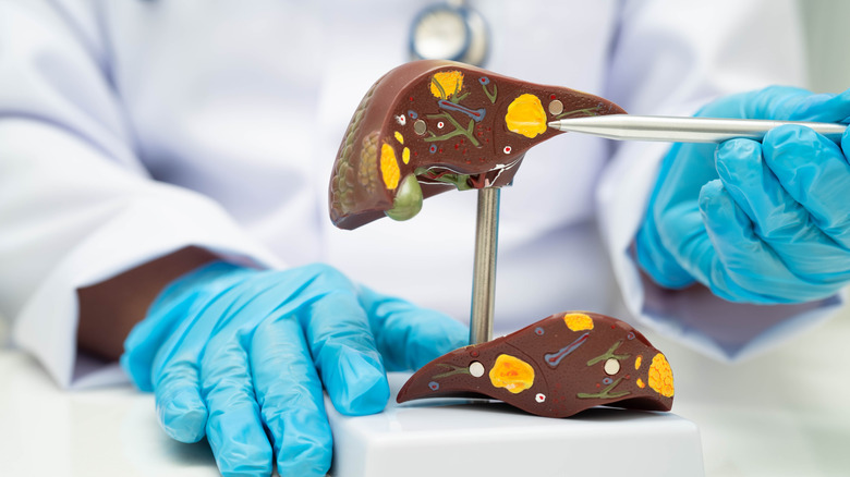 A doctor using a pen to point at a part of the liver