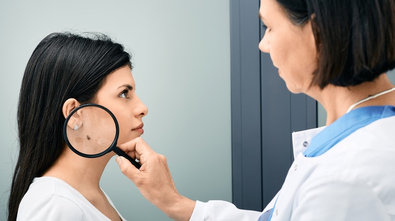 doctor looks at melanoma with magnifying glass