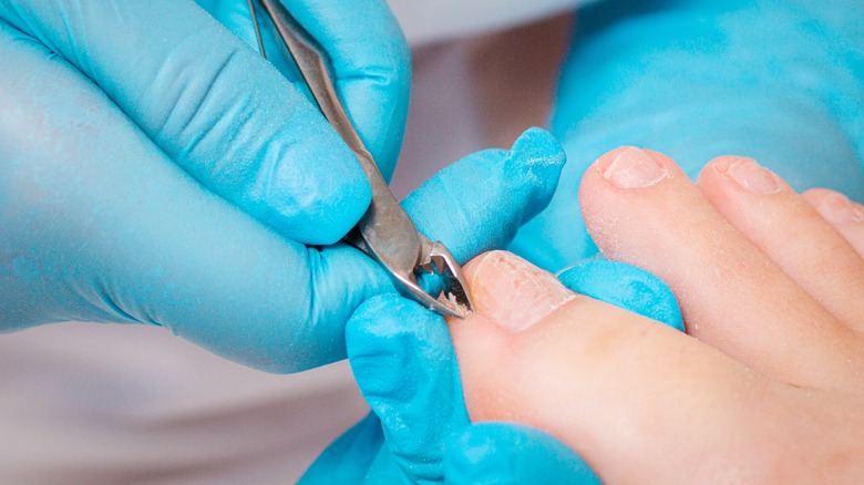 Toe cuticles getting cut