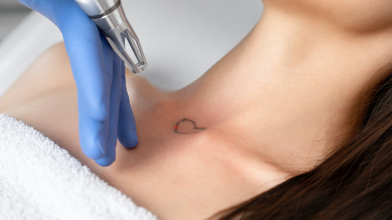 Heart tattoo on neck laser removal