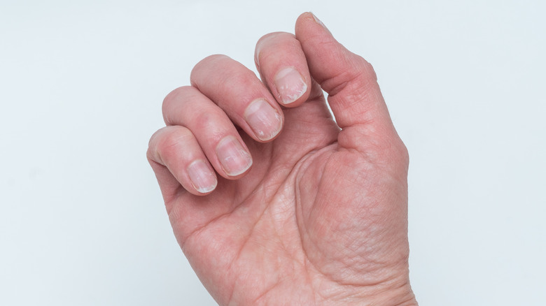 Hand showing damage nails against white background